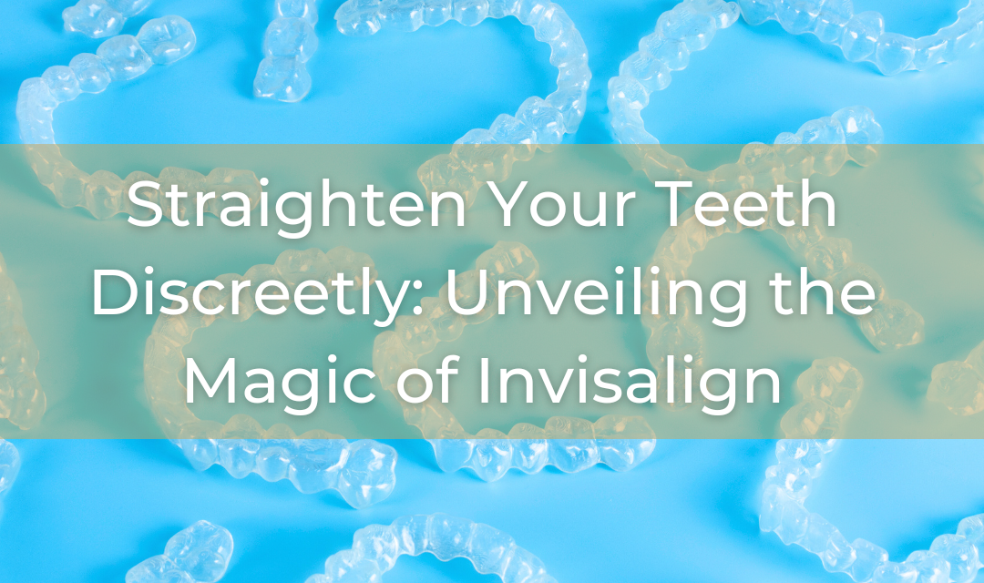 Unveiling the Magic of Invisalign