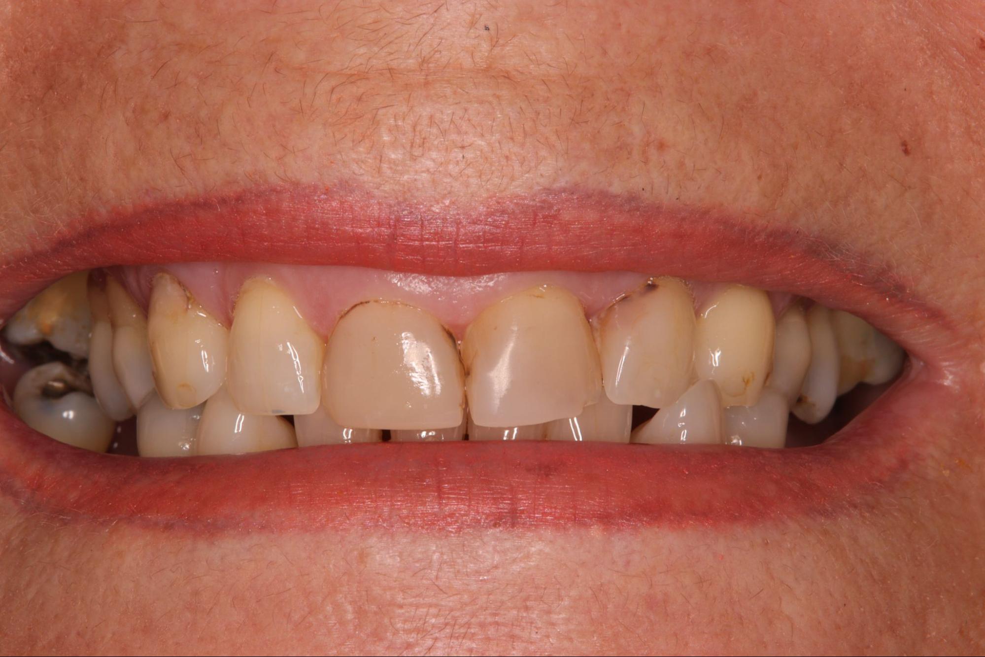 https://droitwichdentalstudio.co.uk/wp-content/uploads/2024/03/image2.jpg