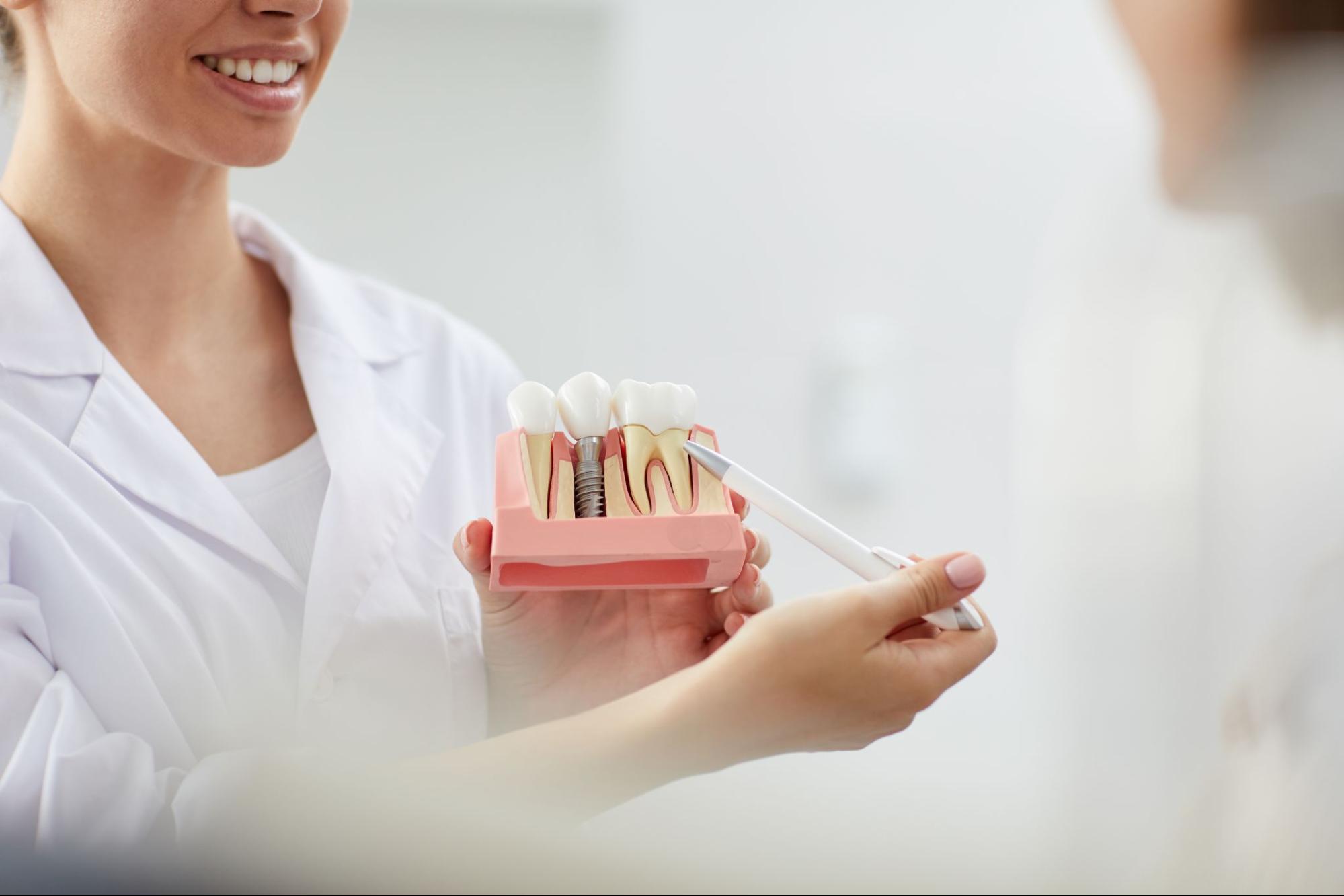 dentist showing patient example of dental implant model