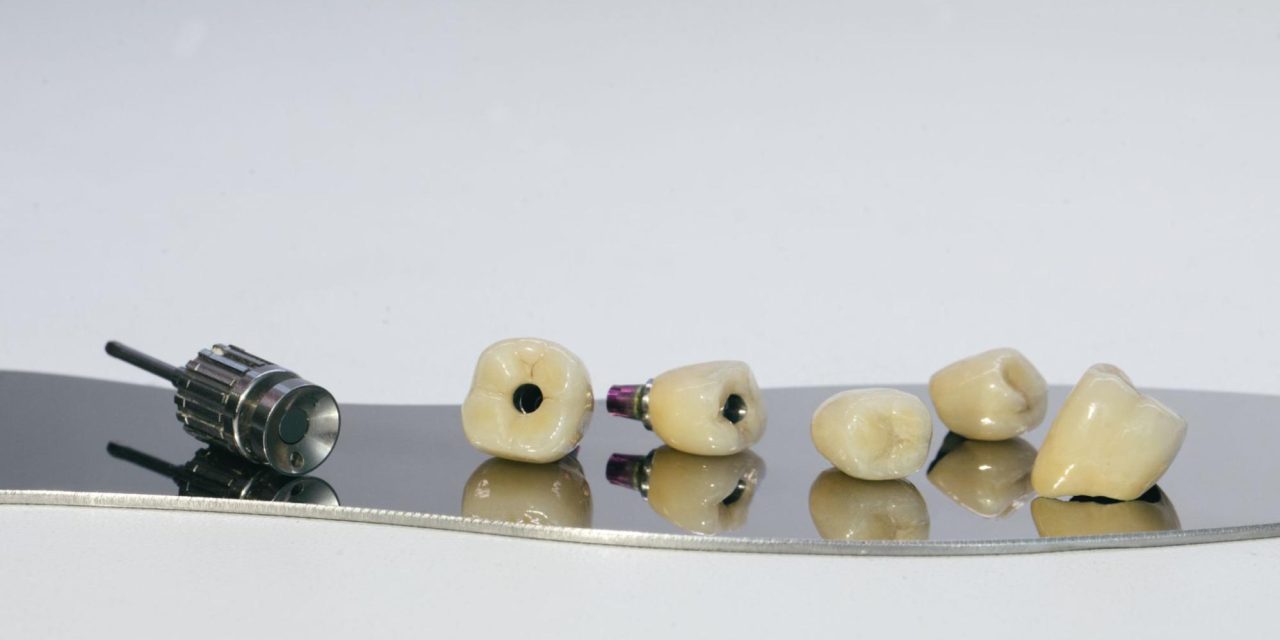 What Is a Dental Implant Screw?