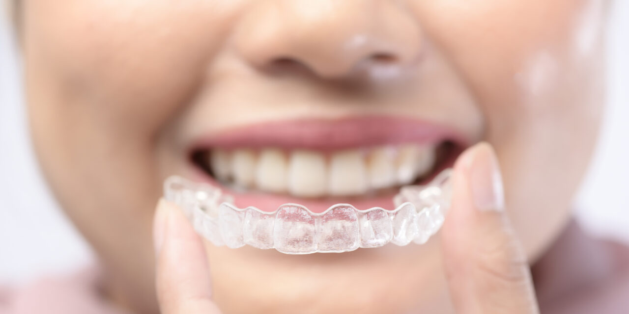 6 Benefits of Invisalign You Didn’t Know About