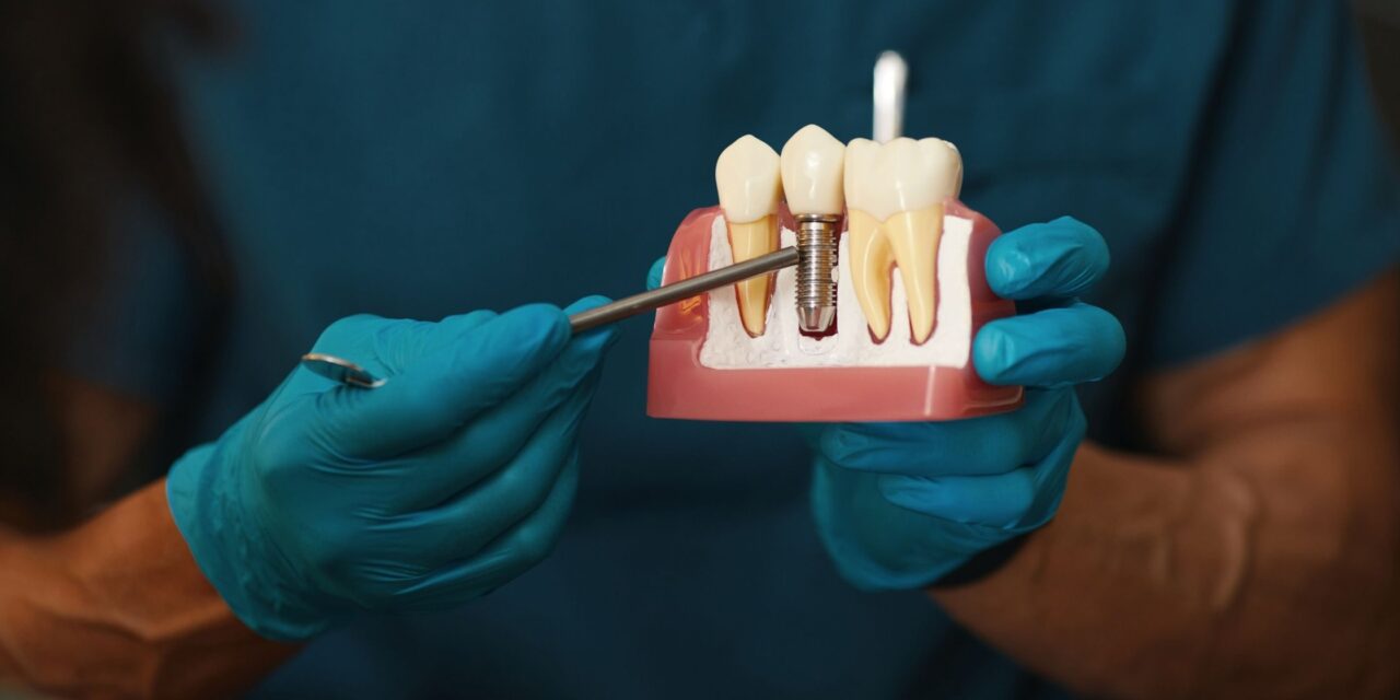 Can You Have a Dental Implant for Just One Missing Tooth?
