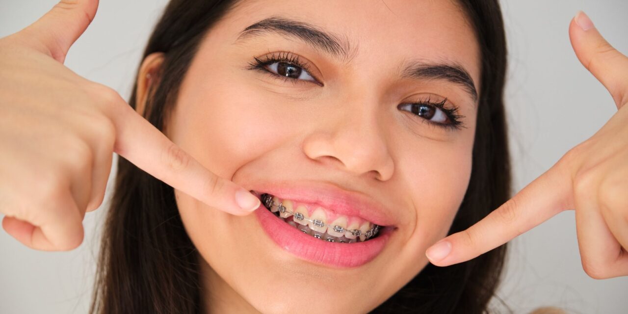 What Can Fixed Braces Correct?